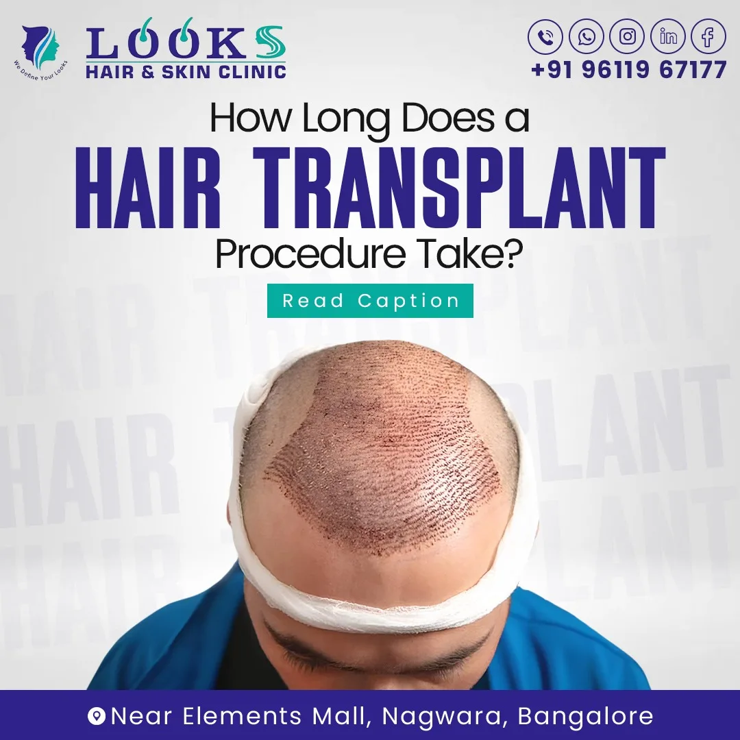 Looks Hair & Skin Clinic – Hair Transplant In Bangalore