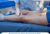 Varicose Veins & Fibroid Embolization Treatment in Delhi | Dr. Pradeep Muley