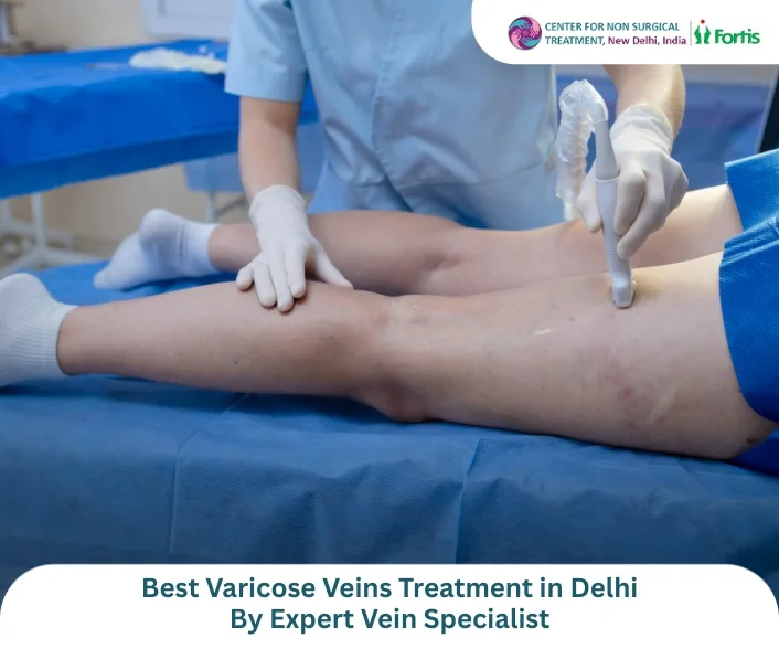 Varicose Veins & Fibroid Embolization Treatment in Delhi | Dr. Pradeep Muley